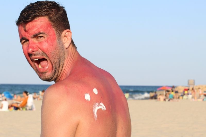 sunburn prevention tips