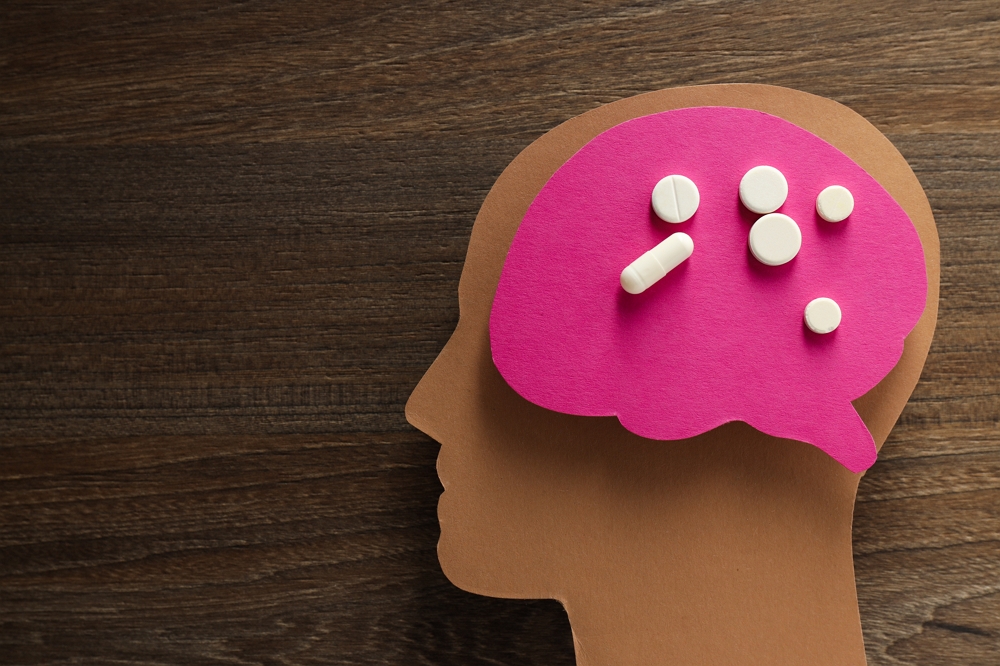 nootropic supplements